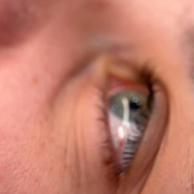 Lash lift result